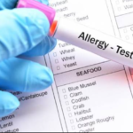 Allergy Test in India: Types, Price, Allergy Panel & What It Detects