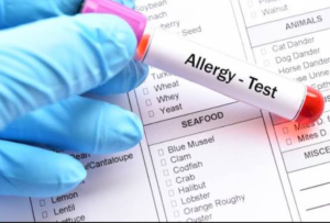 Allergy Test in India: Types, Price, Allergy Panel & What It Detects
